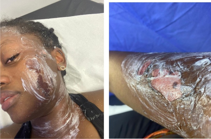 Bank manager's new wife pours hot water on step daughter