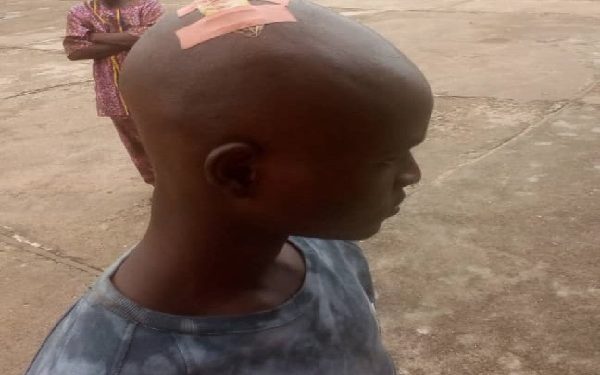 Herdsmen Strike In Kwara: Two Injured,  Farmlands In Kwara Boundary Destroyed