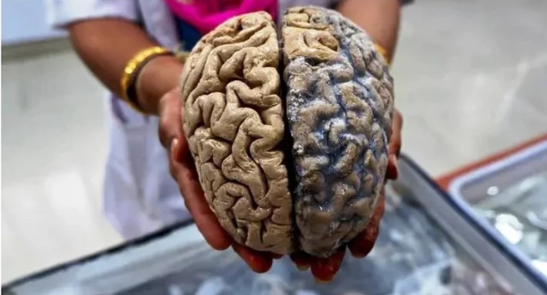 Common Habits That Damage Brain
