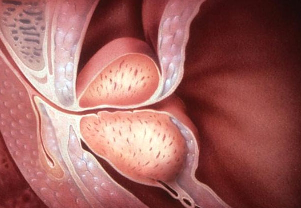 Men's Health Corner: Does Too Much Sex Enlarge The Prostate?