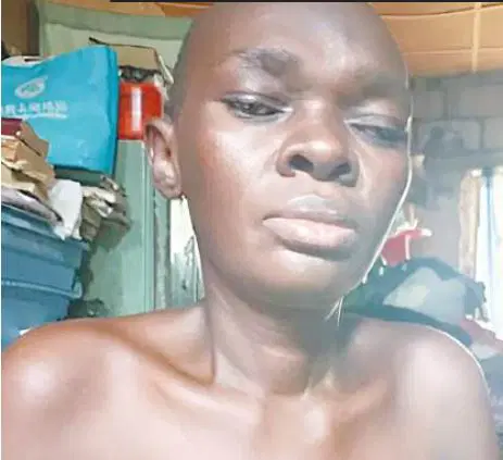 ‘Every day is a battle’: Abuja mother of four races to raise N5m for breast cancer treatment
