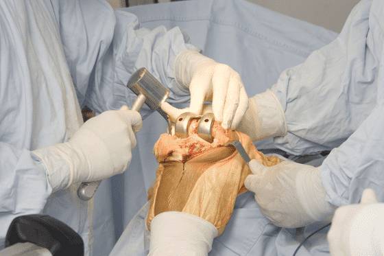 Experts Urge Team-Based Care to Improve Treatment of Bone Injuries and Burn Victims
